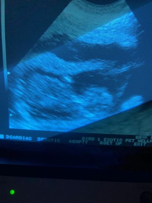 ultrasound.jpeg