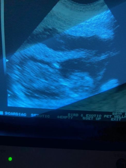 ultrasound.jpeg ultrasound.jpeg